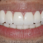 What to Look for in a North London Dentist: Expert Advice