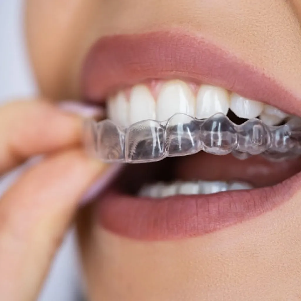 Why More Sydney Residents Are Choosing Invisalign