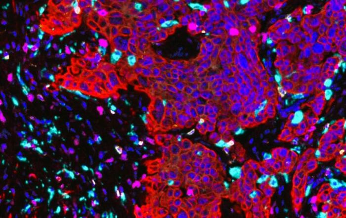 Unlock Cellular Secrets: Precision with Targeted Bioscience LCM Microscope